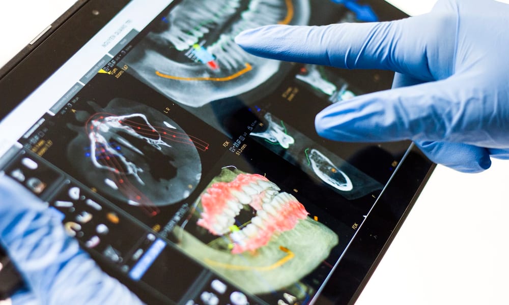 Planificación digital de implantes dentales con estudios de imagen en R&V Dental