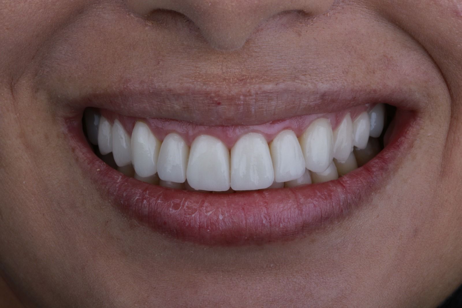 Antes del tratamiento dental RyV Dental